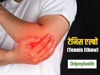 आप जानते हैं टेनिस एल्बो क्या है? जानें इसके प्राकृृतिक उपचार के लिए 5 घरेलू उपाय